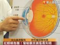 紅眼睛危機！葡萄膜炎搞怪易失明
