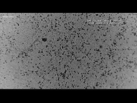 醫生們。流感的威脅比冠狀病毒大得多 (Doctors: Flu a much bigger threat than the coronavirus)