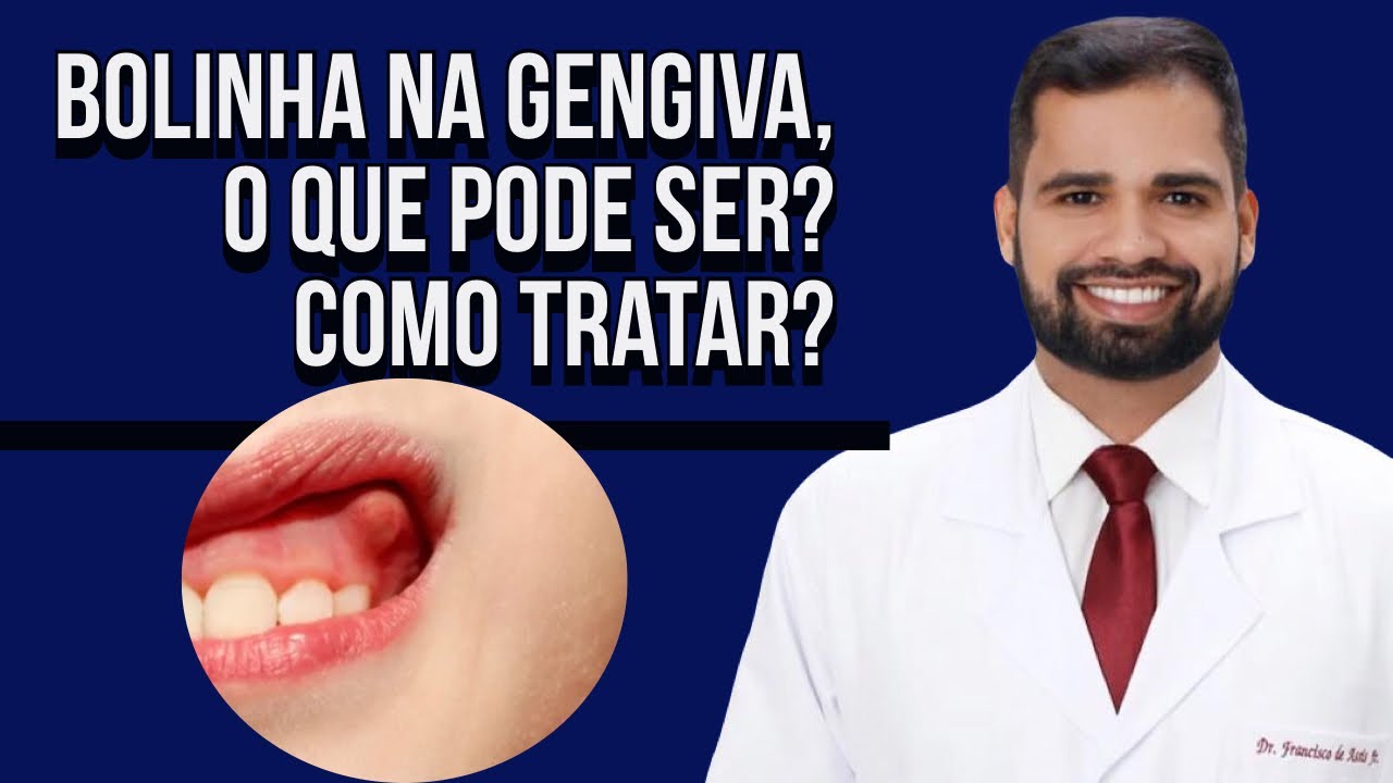 Francisco De Assis Almeida Lima Júnior-70