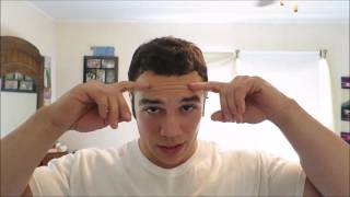 5 month Hair Transplant Progress (FUT 2000 grafts) + PRP