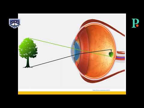asociații vizuale multivitamine pentru a îmbunătăți vederea
