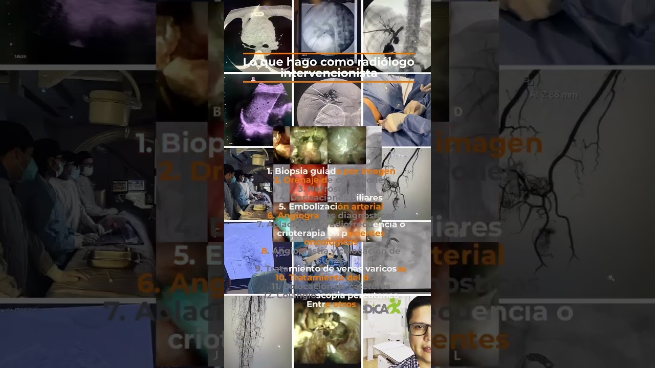 Jose Andres Burgos Zuleta-9