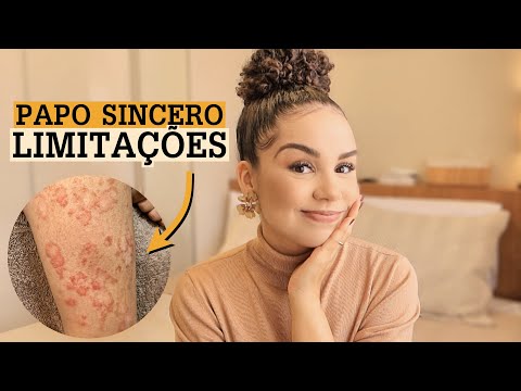 Bate papo: reflexão sobre defeitos e limitações + meu caso de pitiríase rósea