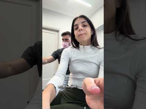 ΜΟΥ ΑΝΟΙΞΕ ΚΕΝΟ ΣΤΑ ΔΟΝΤΙΑ 🫣 @athens.dentalcare