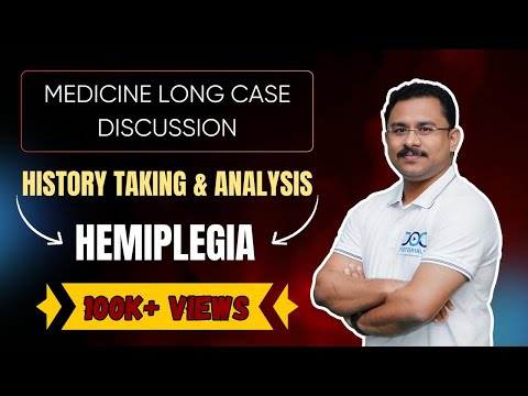 MEDICINE LONG CASE DISCUSSION  HISTORY TAKING & ANALYSIS - STROKE BY  Dr Rahul Rajeev MBBS MD DM
