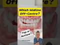 Is Your Top or Bottom Dental Midline Off-Center? How to Tell! #dentallan #dentist #shorts