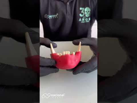 MANDÍBULA COM ALGUNS DENTES E GENGIVA - cód. 4012GT