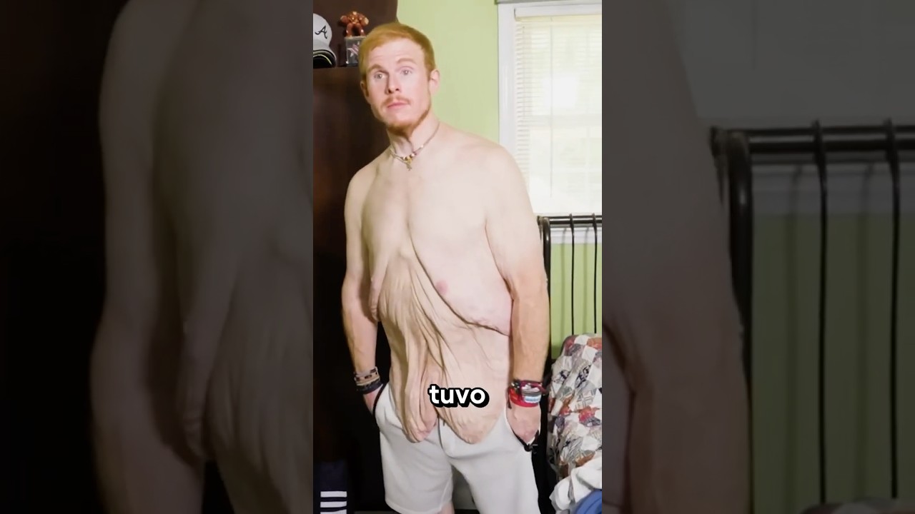 Perdió 600 libras y transformó su vida