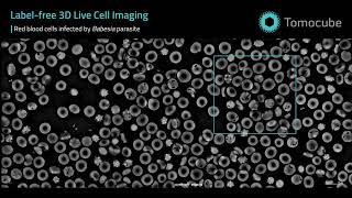 Babesia-Infected Red Blood Cells | 3D Live Cell Time-Lapse Imaging with Holotomography