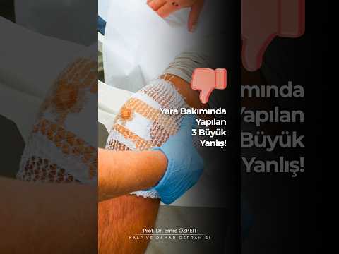 Yara Bakımında Yapılan 3 Büyük Yanlış!