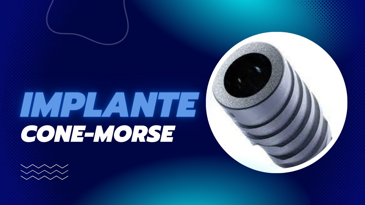 CONE MORSE - UM ÓTIMO SISTEMA DE IMPLANTE