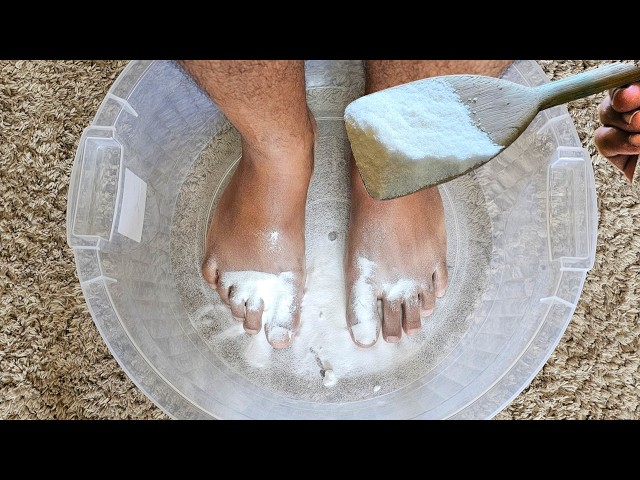 Coloquei BICARBONATO de SÓDIO nos meus PÉS e olha o que aconteceu