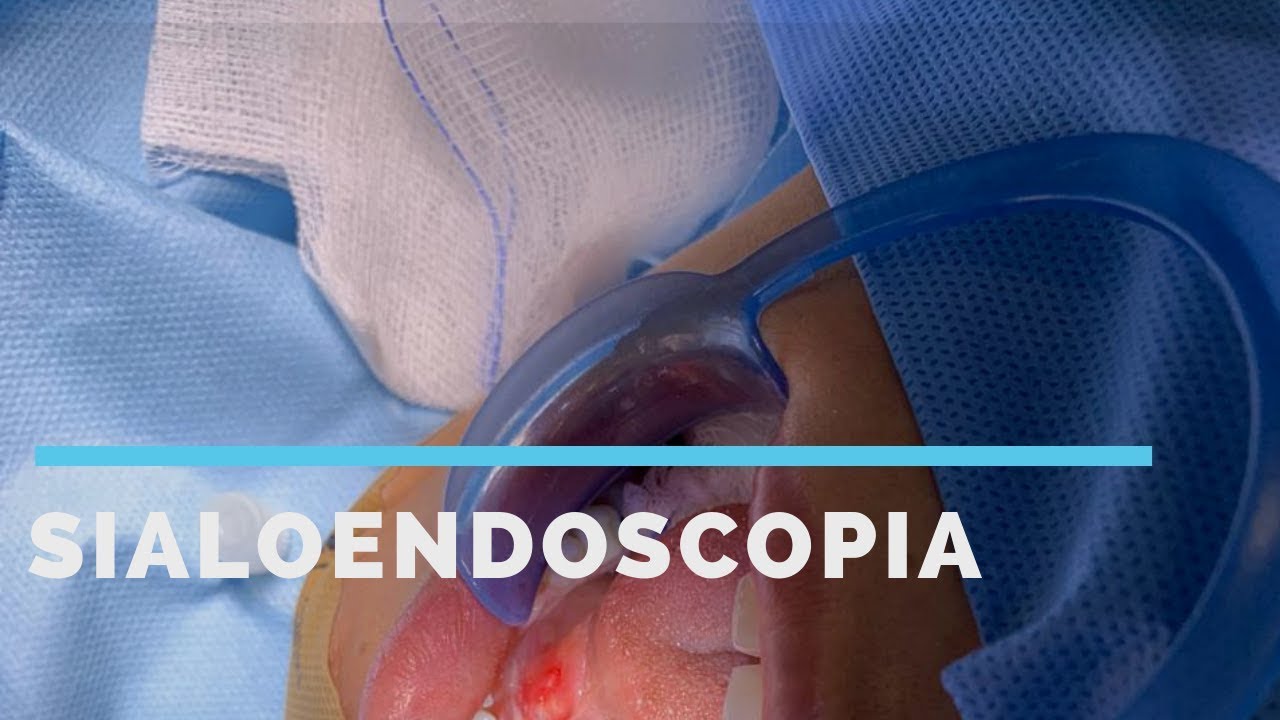 Giulianno Molina De Melo-85