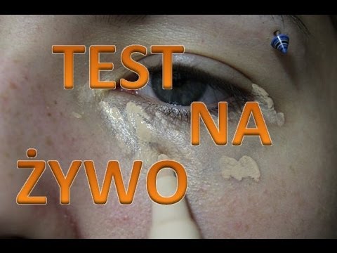 Ortezy gdy koślawego Nowosybirsk Dlaczego powstaje na kości nóg w kciuka