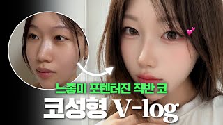 포텐터진 직반 코 성형 후기 | 코성형 브이로그