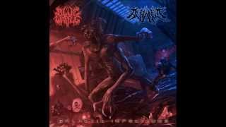 Acrania - Susceptible To Retinal Based Reprogrammability [WITH LYRICS AND FREE DOWNLOAD]