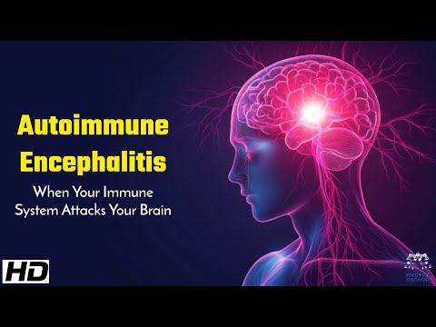 Autoimmune Encephalitis : When Your Immune System Attacks Your Brain