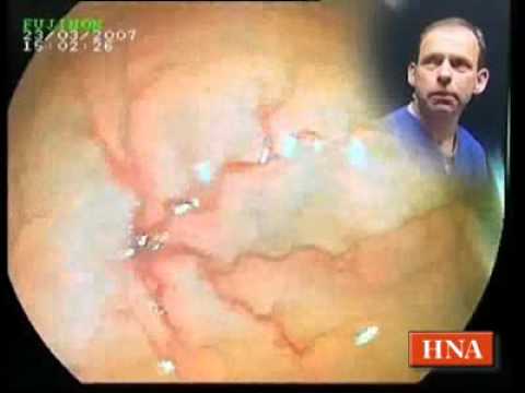 Prostatitis ihren Mann, ob es notwendig ist, sich zu schützen Massage. Prostata-Video-Tutorial