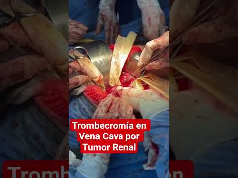 Lázaro Sánchez Vicuña-18