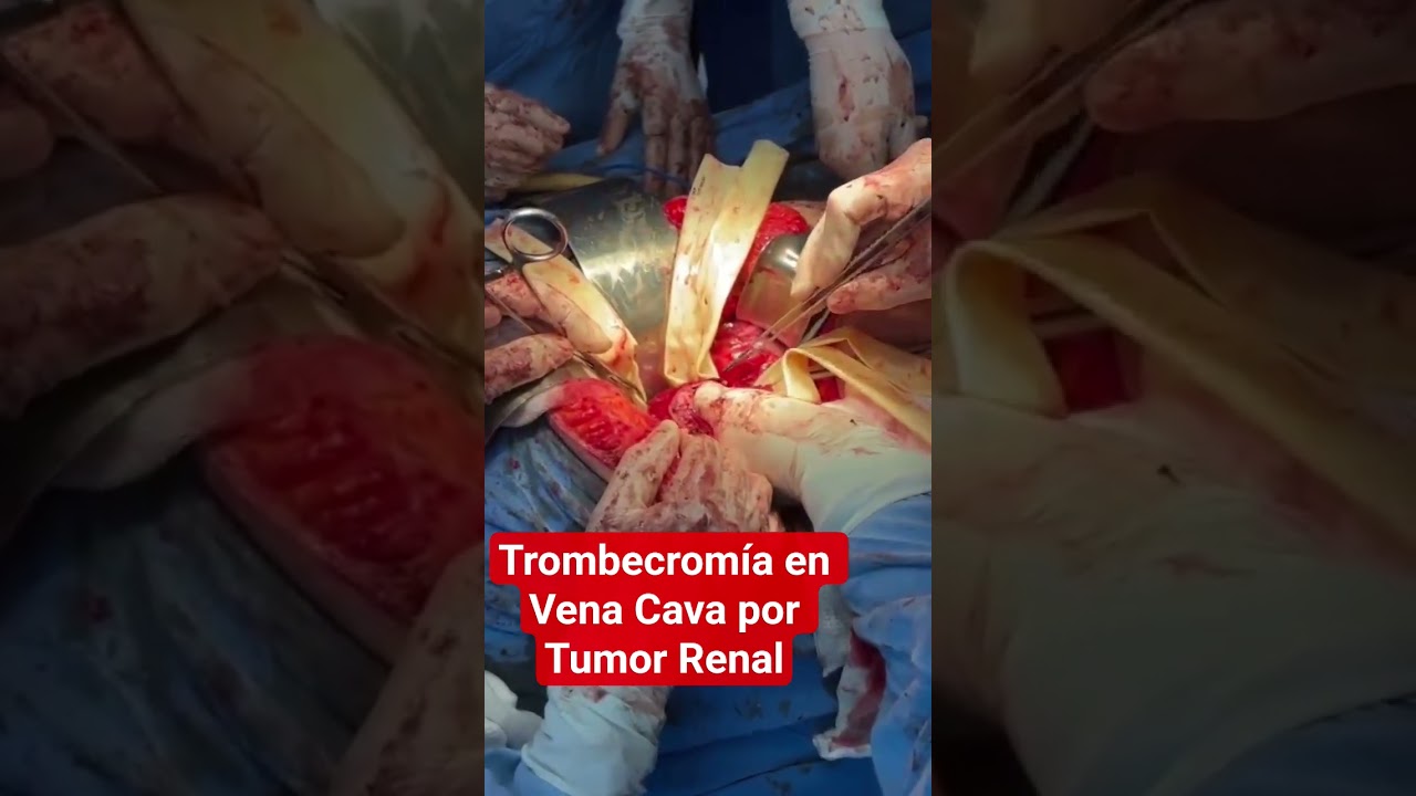 Lázaro Sánchez Vicuña-18