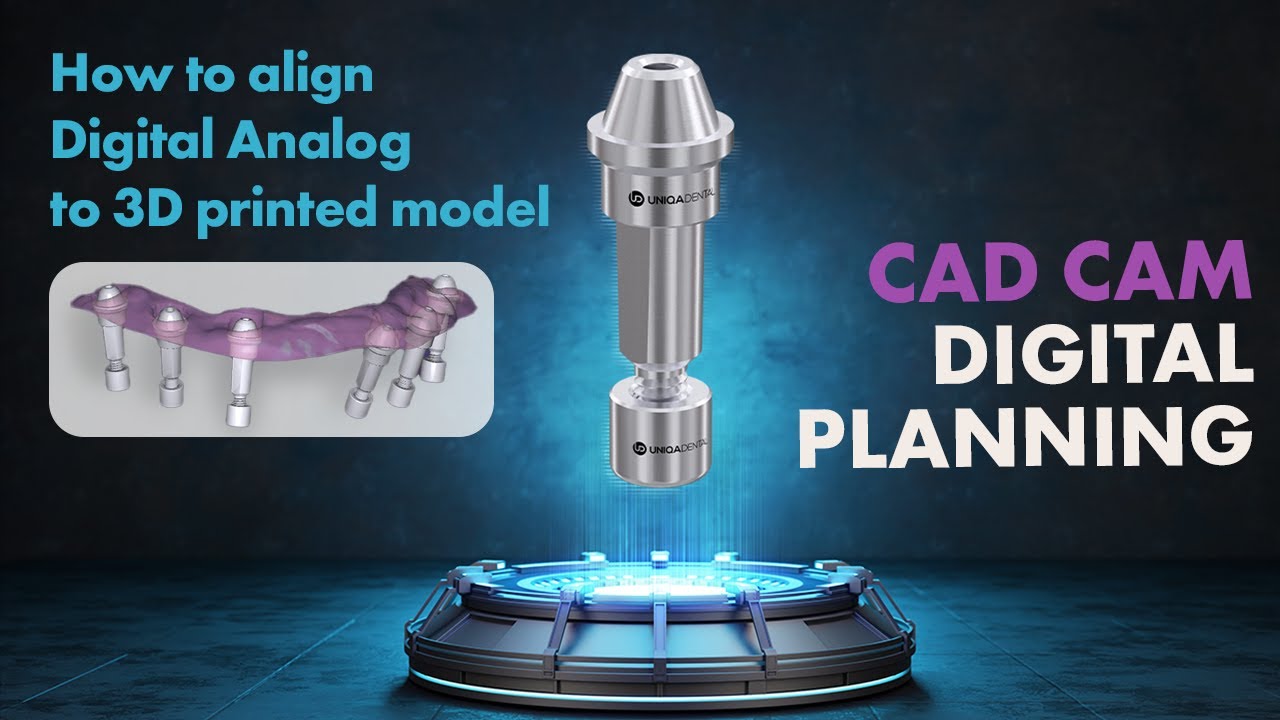 How to align Digital Analog to 3D printed model of dental implant | CAD CAM Digital Planning