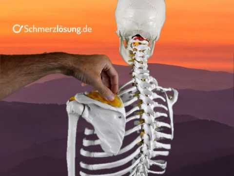Schmerzen von der Hüfte bis zur Ferse strahl Behandlung der Brustwirbelsäule SHmorlja