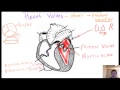 Heart valves 