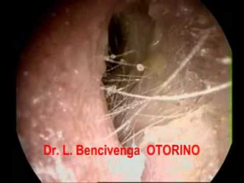 La medicina di eczema ultima Che fare a dermatite atopic a bambini
