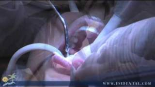 Oral Surgery in Commack, NY