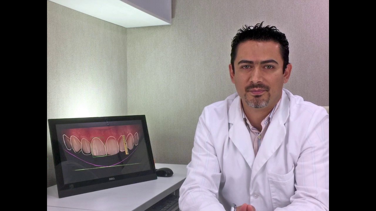 Raúl Euán Salazar-20