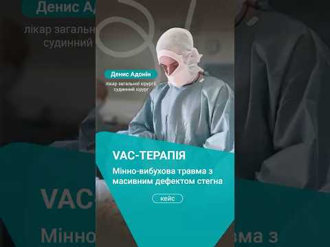 аутодермопластика