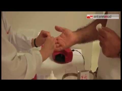 TGSRVgiu16 trasfusione infetta