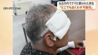 「クマだと思った瞬間、倒された」仙台市で今年初の人身被害　顔や手に傷痕残る男性が当時の恐怖を語る (26/08/19 18:15)