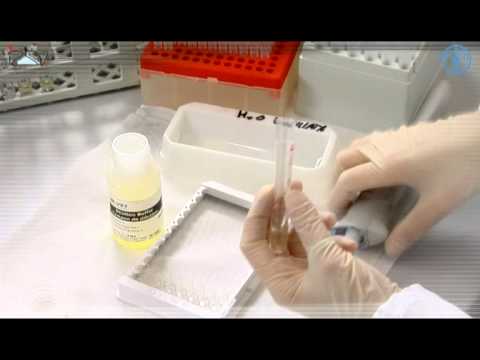 ELISA - Indirect e te compétition