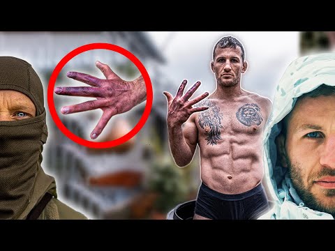 Schwere Erfrierungen nach dem Arctic Warrior - KSK Tom & ich reagieren