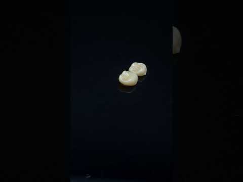 YouTube 썸네일