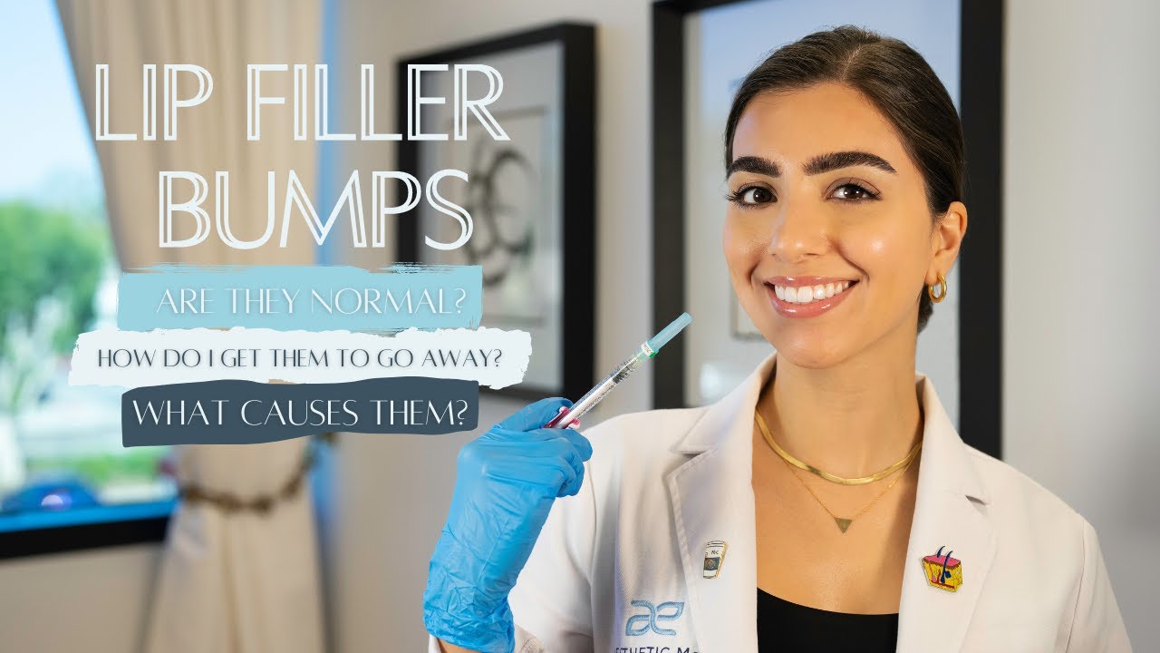 Lip Augmentation Marina del Rey Lip Fillers Santa Monica