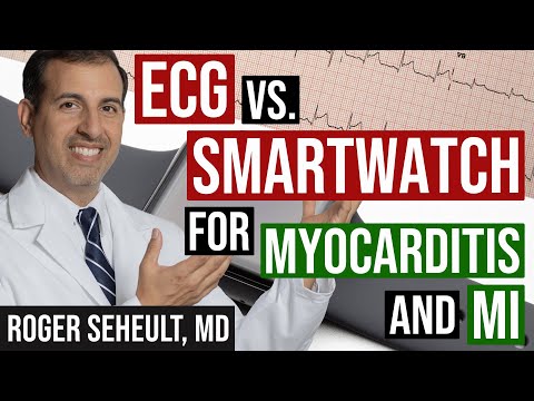ECG/EKG Versus Smartwatch for Myocarditis/Pericarditis and Myocardial Infarction