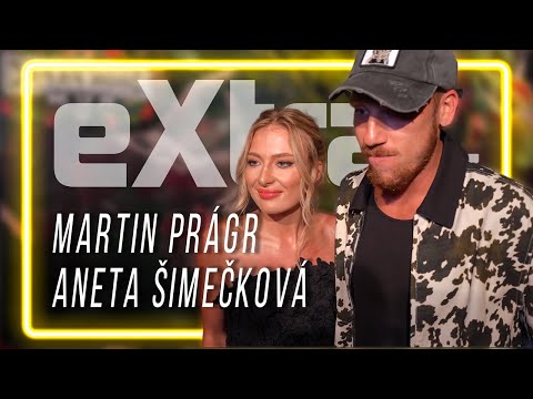 Martin Prágr s novým účesem: Otevřeně promluvil o své transplantaci vlasů