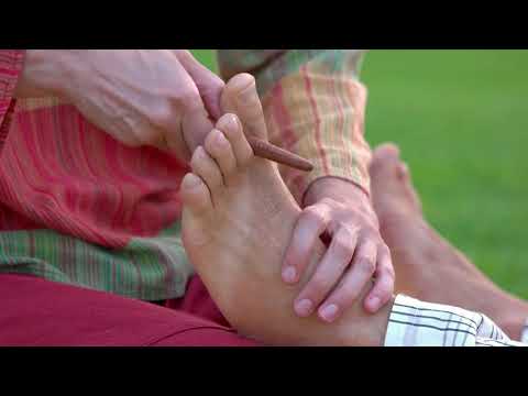 Koji su uzroci smrdljivog mirisa stopala?