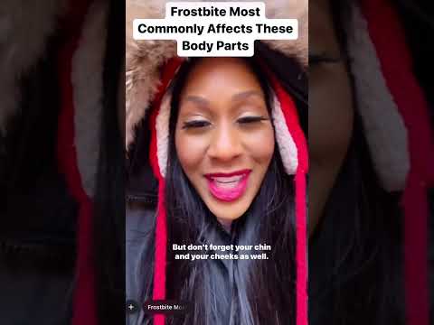 Frostbite 🥶 Most Commonly Affects These Body Parts 🧤! #shorts