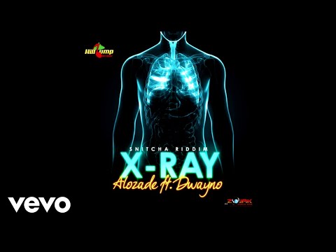 Dwayno, Alozade - Xray (Audio Video)