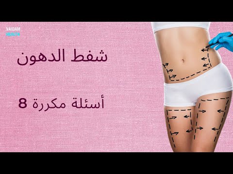 الأسئلة المتداولة حول شفط الدهون