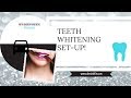 My Professional Teeth Whitening Set Up