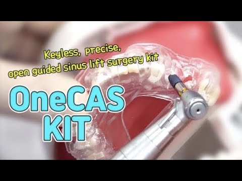 [EASY Hands-on] OneCAS KIT - #25, #26 Missing Case [English]