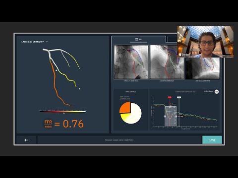 Dr. Rahul P. Sharma Introduces the CathWorks FFRangio System - Highlight from CVIT Presentation