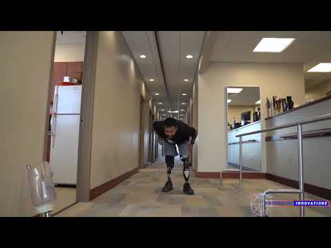 Pisay Tan Jump | Bilateral Amputee | Ottobock Genium X3