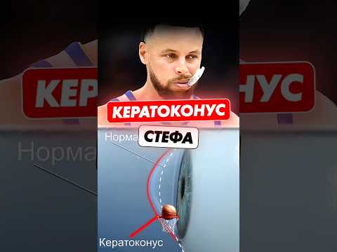 😮👀КЕРАТОКОНУС  Стефа