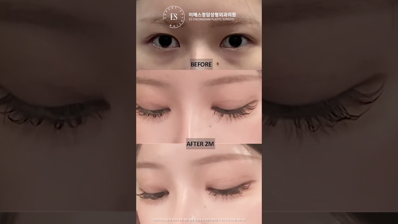 이에스 유튜브