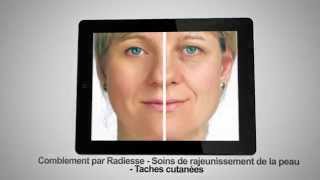 Médecine esthétique Nantes